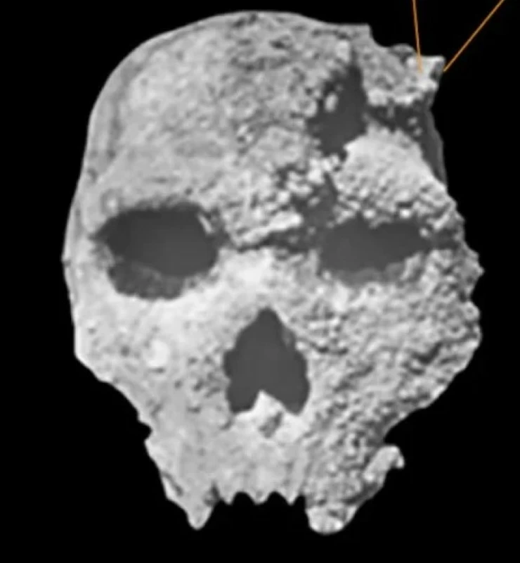300,000 years ago…Greek skull redraws the lineage of human evolution – Saudi News